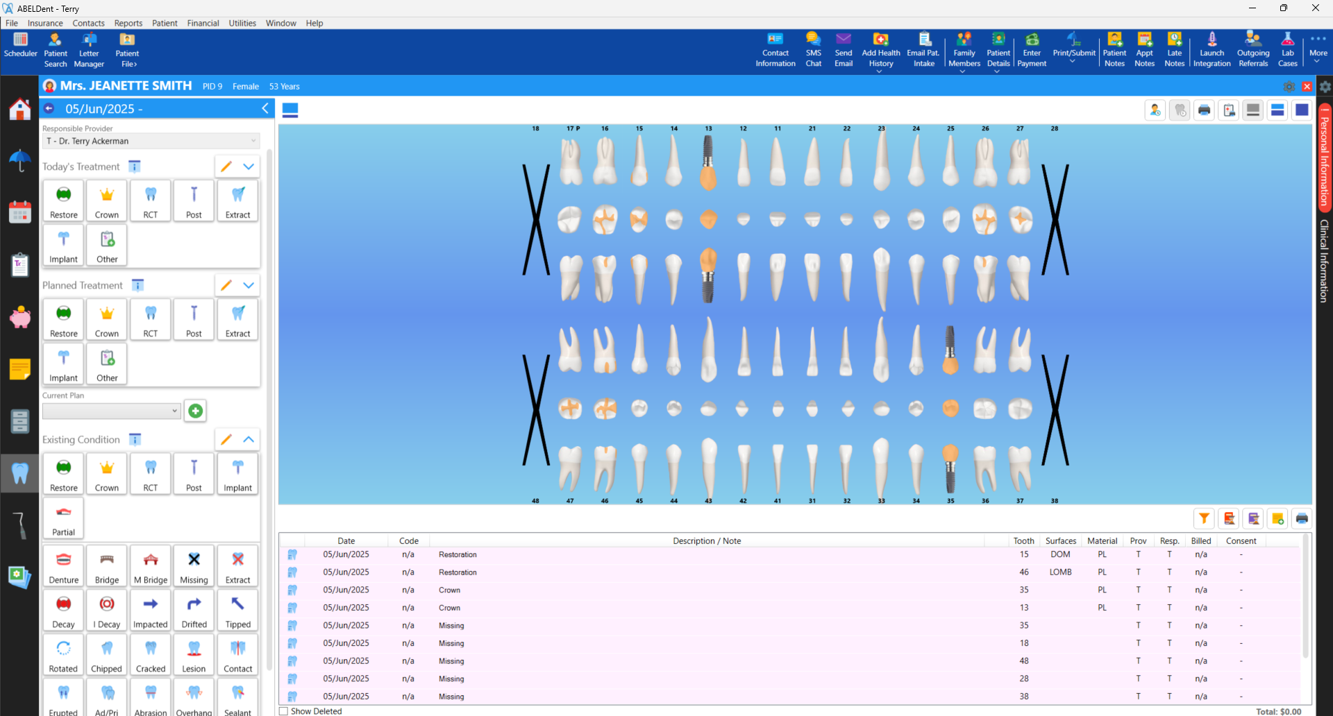The Patient Charting Tab in ABELDent. The Chart shows multiple existing conditions for the patient.
